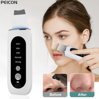 Black Dots Blackhead Remover Facial Peeling Machine