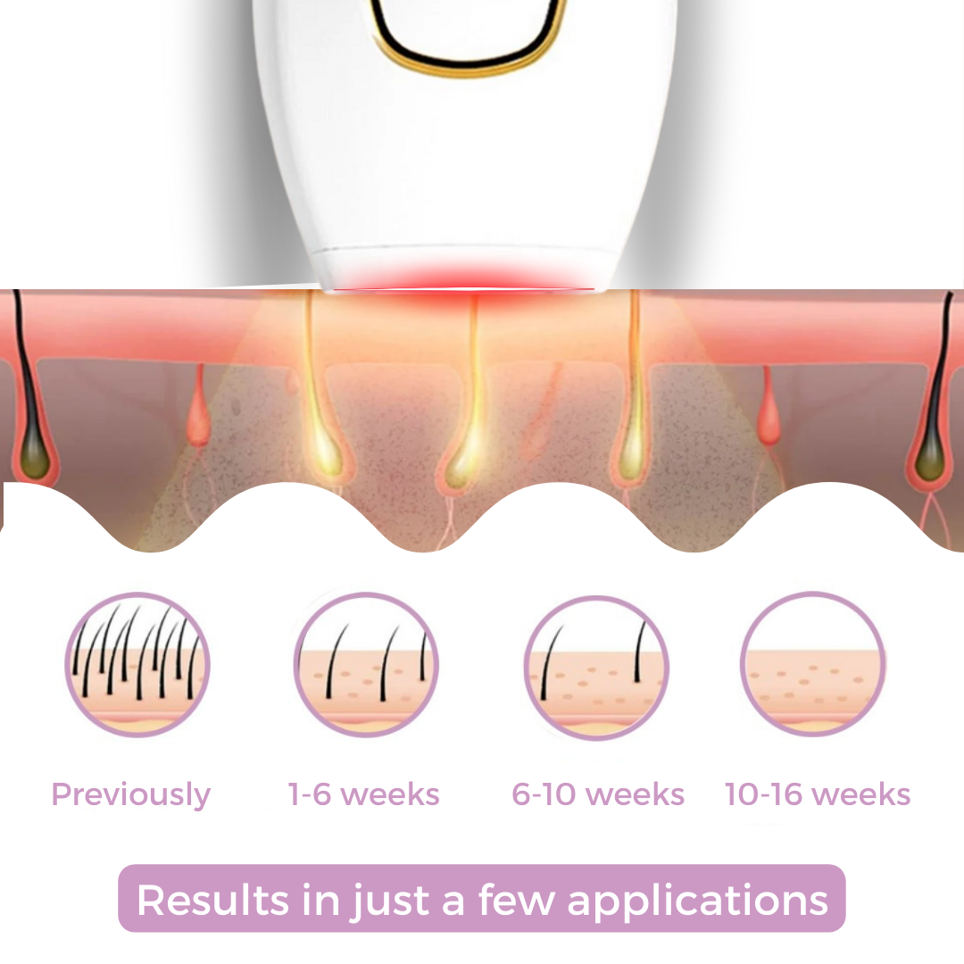 Mini Laser Hair Remover