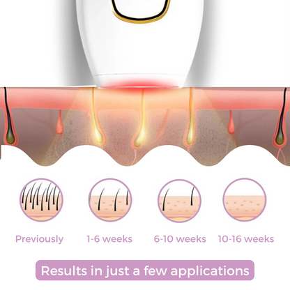 Mini Laser Hair Remover
