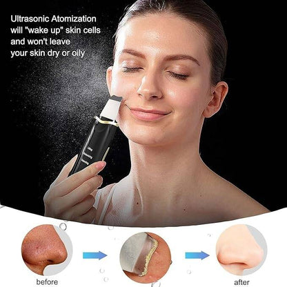 Black Dots Blackhead Remover Facial Peeling Machine