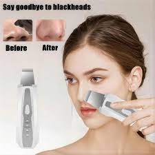 Black Dots Blackhead Remover Facial Peeling Machine