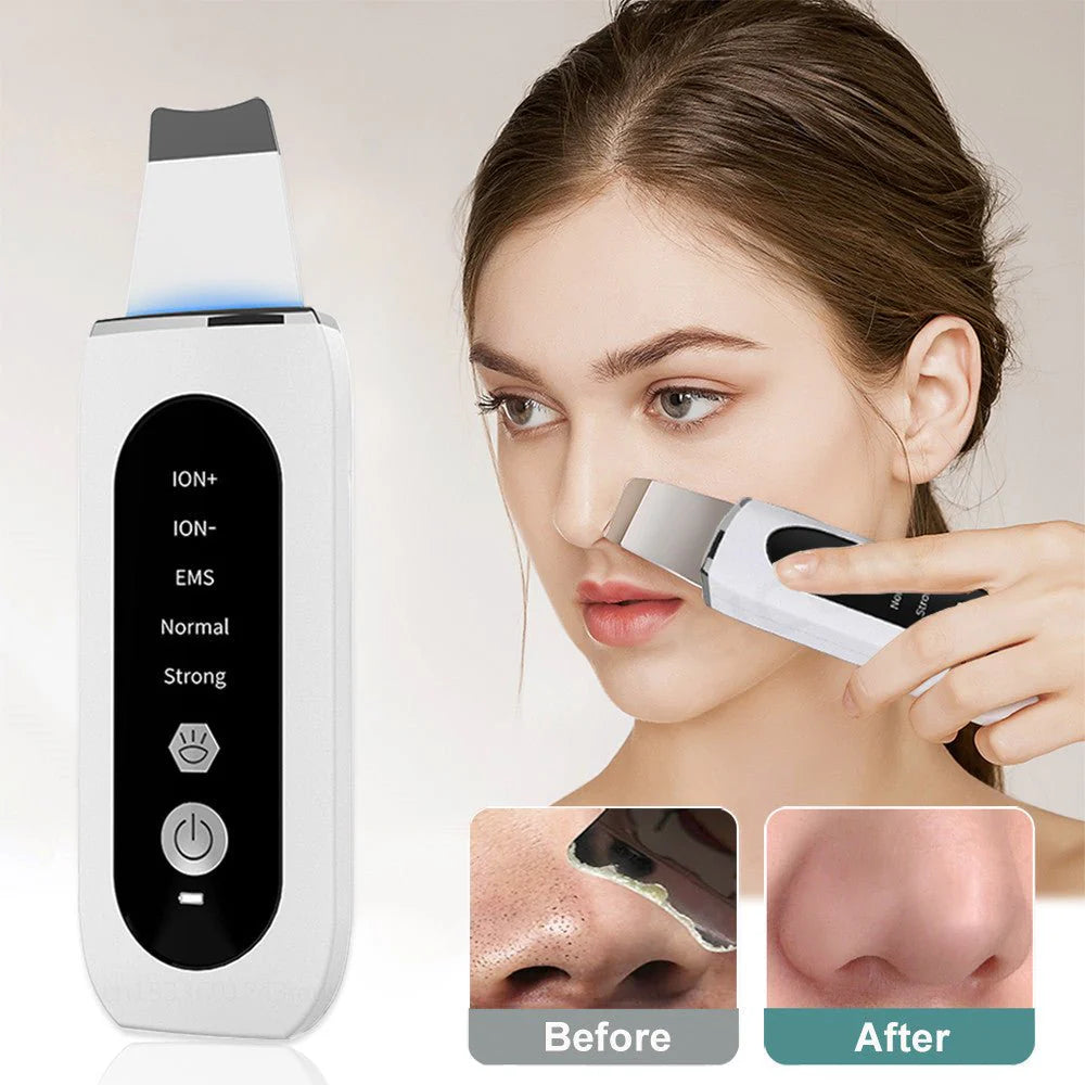 Black Dots Blackhead Remover Facial Peeling Machine